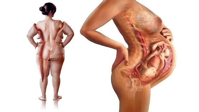 Postpartum and Weight Loss