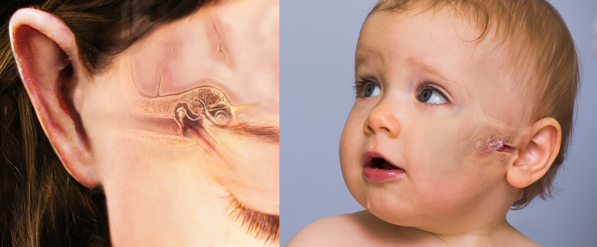 Ear Eczema: Symptoms, Causes \u0026 Treatments - Soteri Skin, image size:1920x796