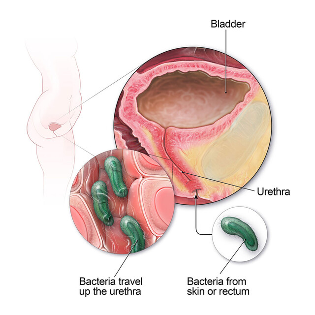 Cigarettes After Sex? Try Peeing Instead to Prevent a UTI