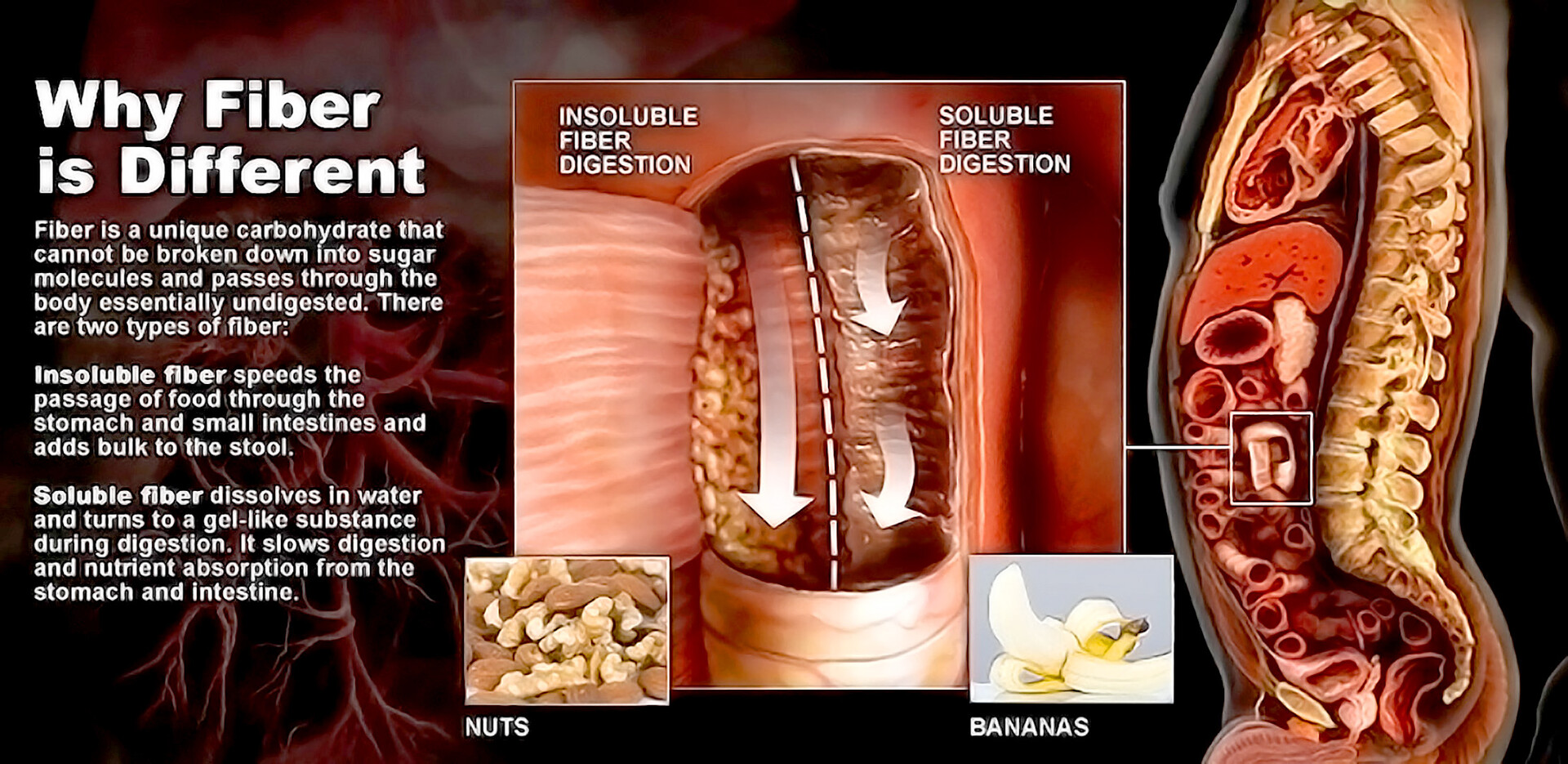 Soluble Vs Insoluble Fiber StoryMD