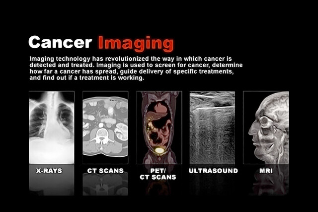 Putting Cancer Screening in Perspective