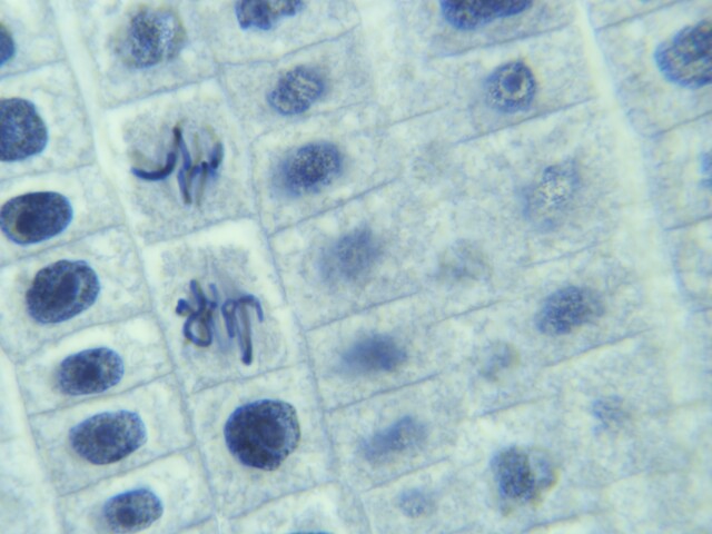 Metaphase In Plant Cell Under Microscope