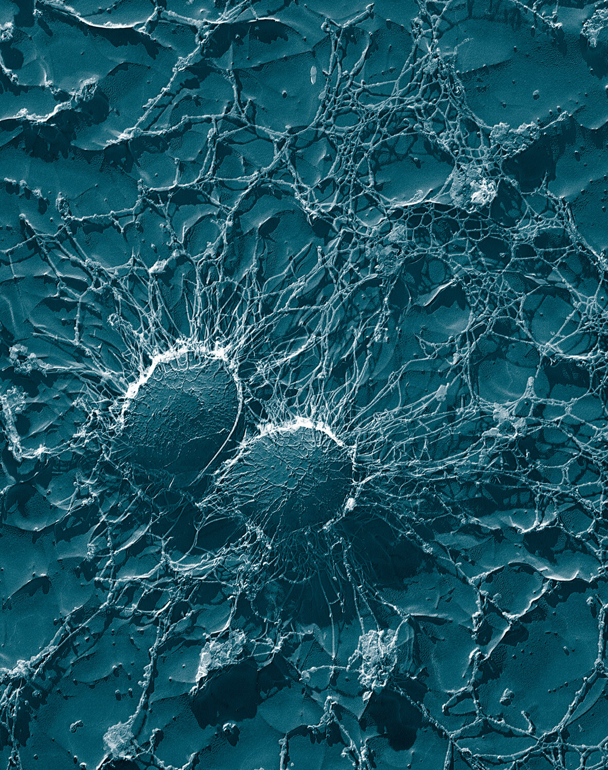 Staphylococcal Infections - StoryMD