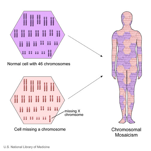 What Does It Mean To Have A Mosaic Form Of Klinefelter Syndrome Storymd 