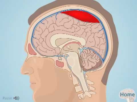 Thoracentesis - StoryMD