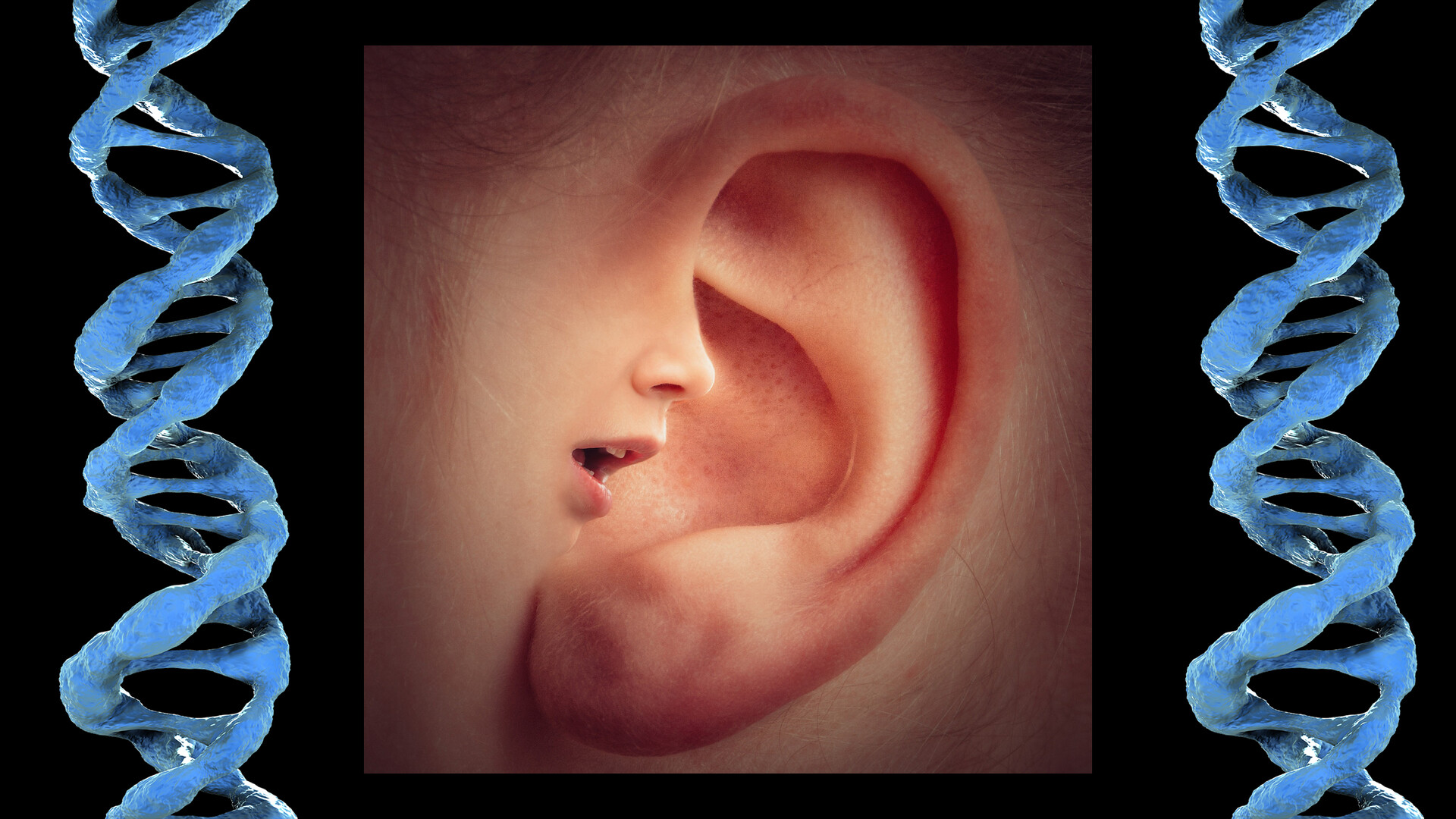 of Hearing Loss StoryMD