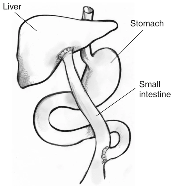 5: Digestive system of an adult female Extatosoma tiaratum... | Download  Scientific Diagram