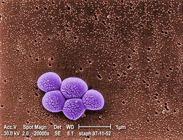 Staphylococcal Infections - StoryMD