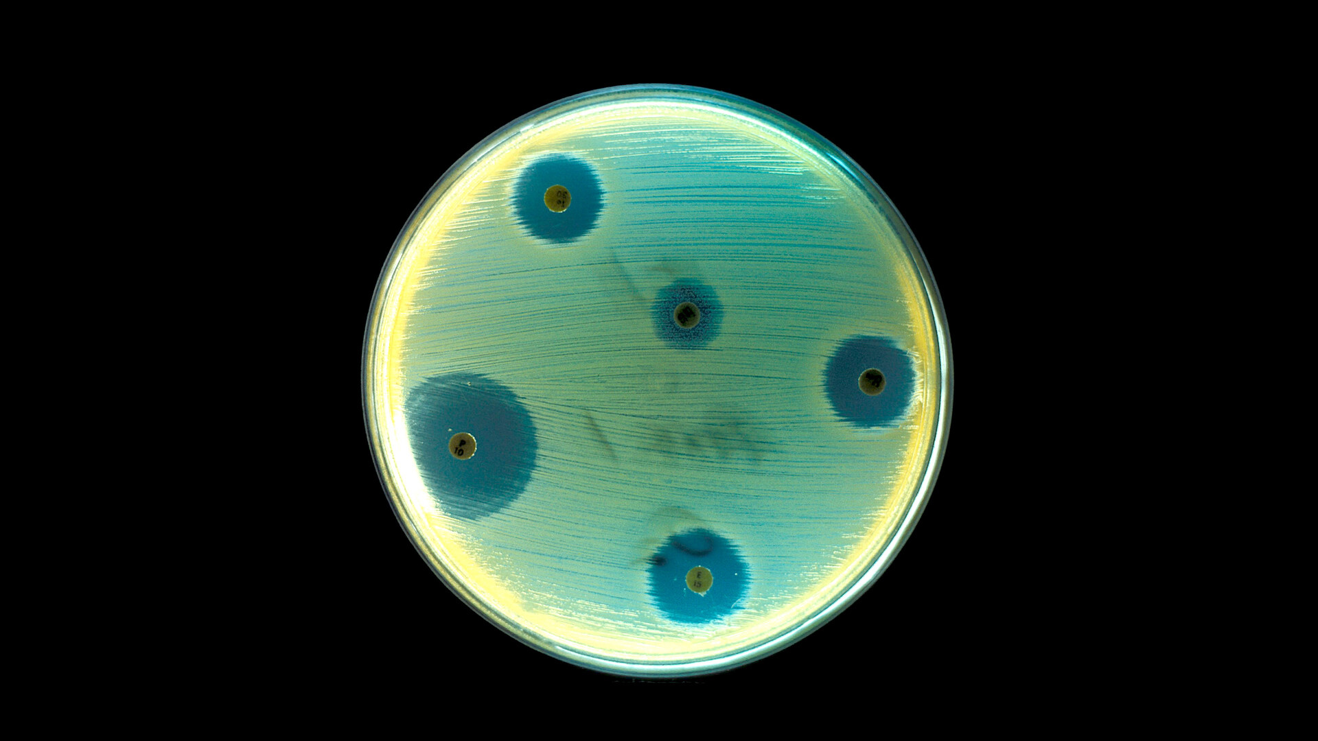 Staphylococcal Infections - StoryMD