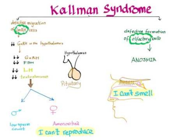 Kallmann Syndrome Medlineplus Genetics 59 Off