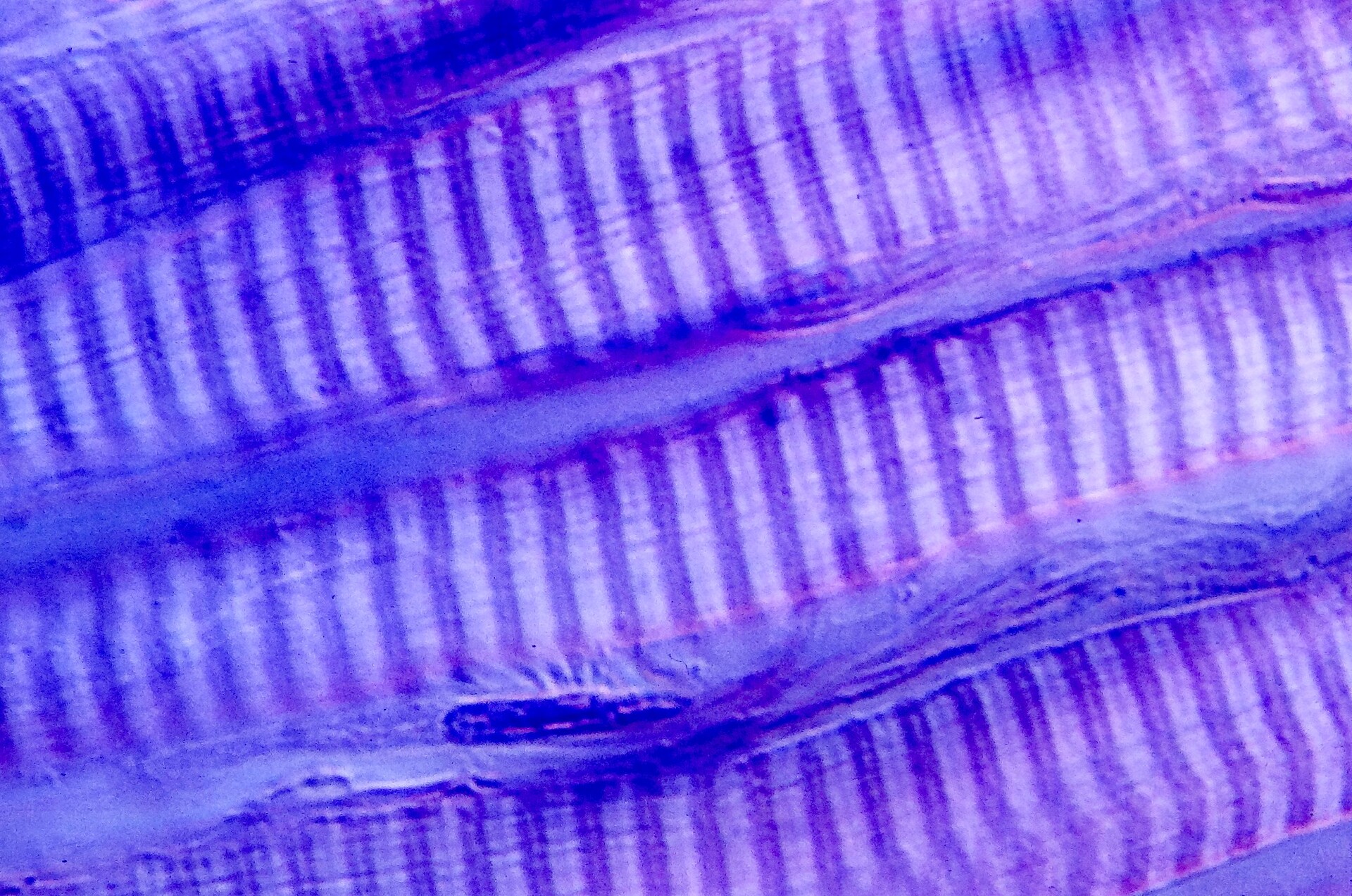 types-of-skeletal-muscle-fibers-storymd