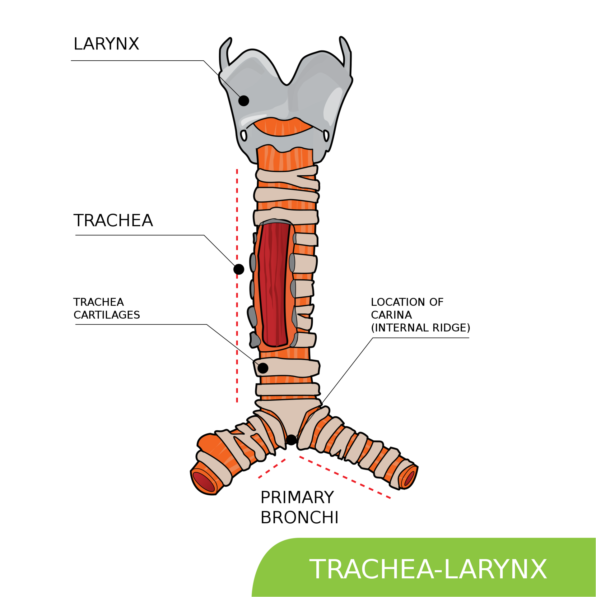 What Is Tracheal Agenesis? - StoryMD