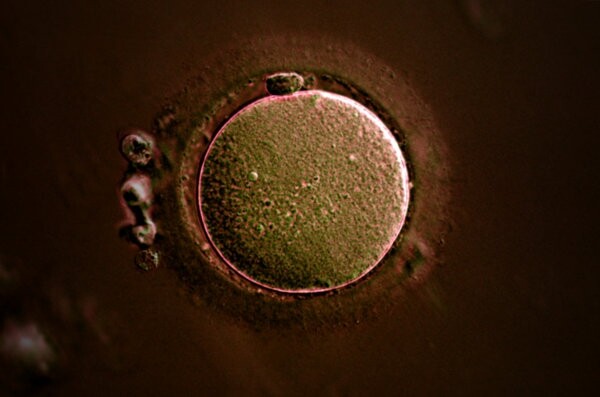 Corona Radiata (Embryology)