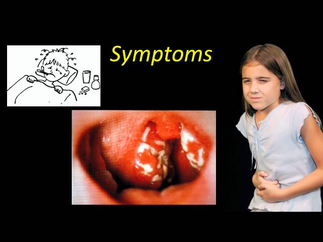 Strep A and Scarlet Fever Information - Munro Medical Centre