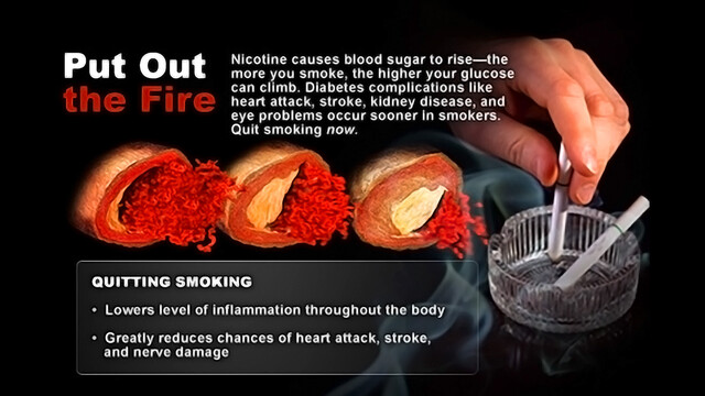 do cigarettes raise blood sugar Diabetes Is Creeping Up, But You Have the Power to Prevent It
