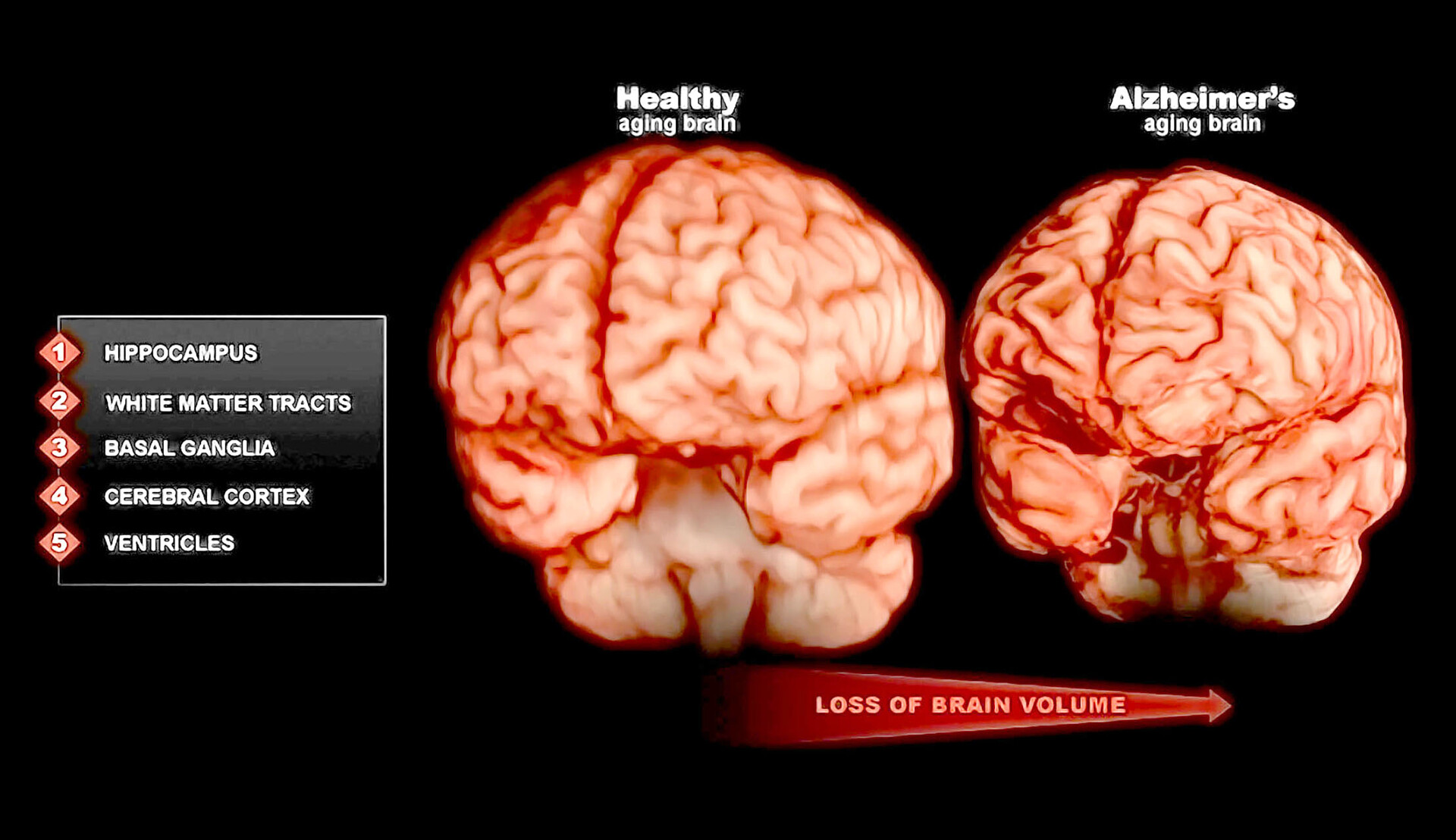 Brain health and aging