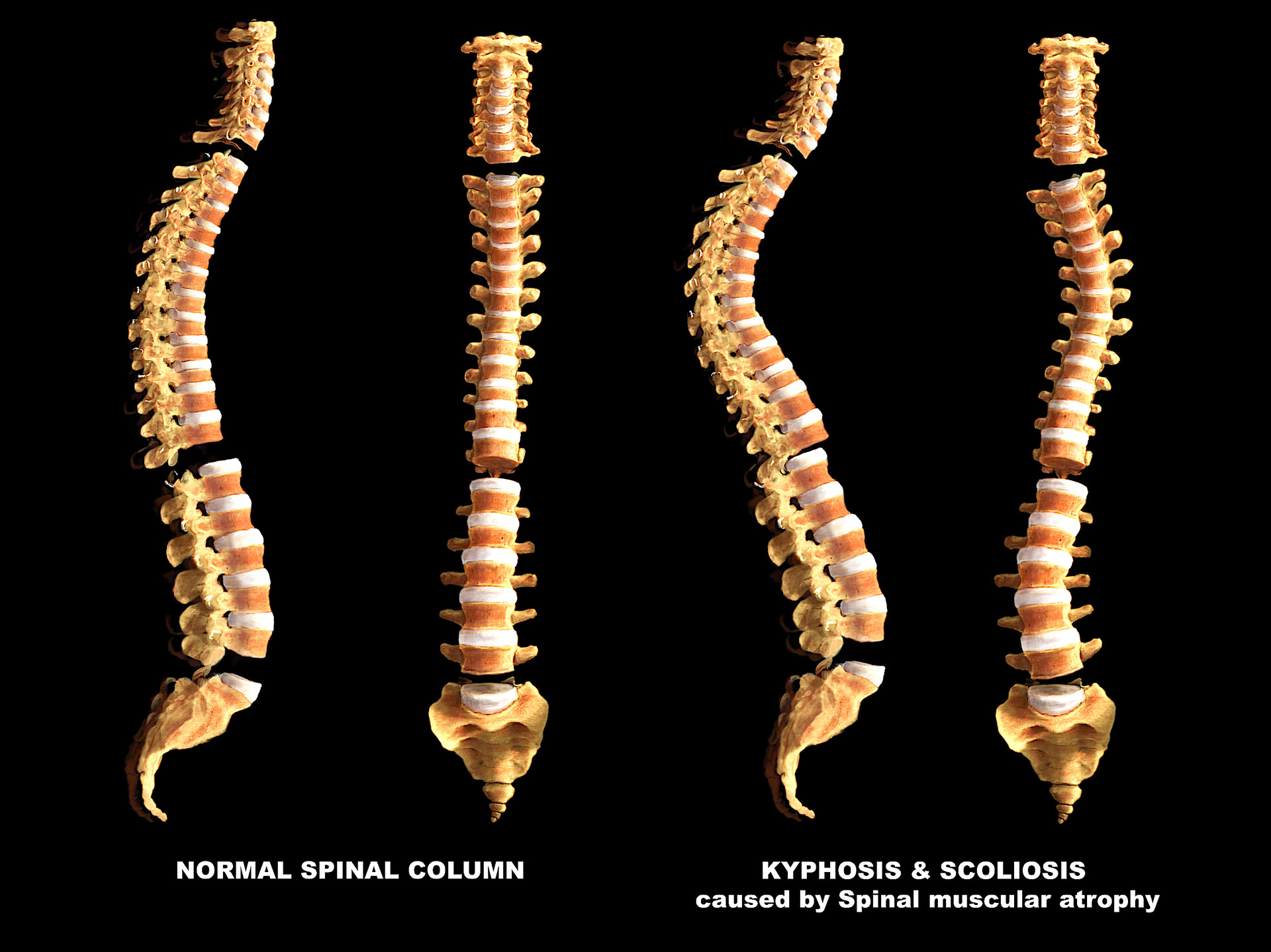 Curvatures Of Vertebral Column StoryMD