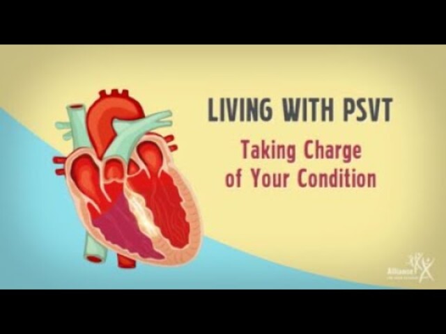 Paroxysmal Supraventricular Tachycardia - StoryMD