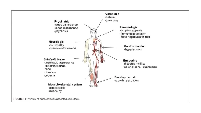 What Causes Cushing Syndrome? - StoryMD