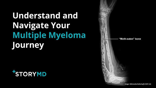 Watch: StoryMD Helps Multiple Myeloma Patients Understand and Navigate Their Health in Real Time