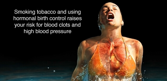 tobacco abuse icd 10 Z87.891 – Personal history of nicotine dependence