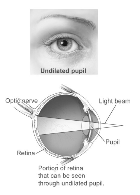 Retina Test, Fundus Checkup, Dilated test, Diabetes in retina