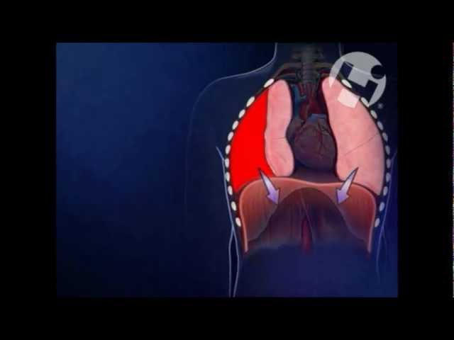 Thoracentesis - StoryMD