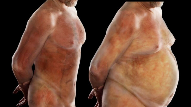 Weight Loss Before and After