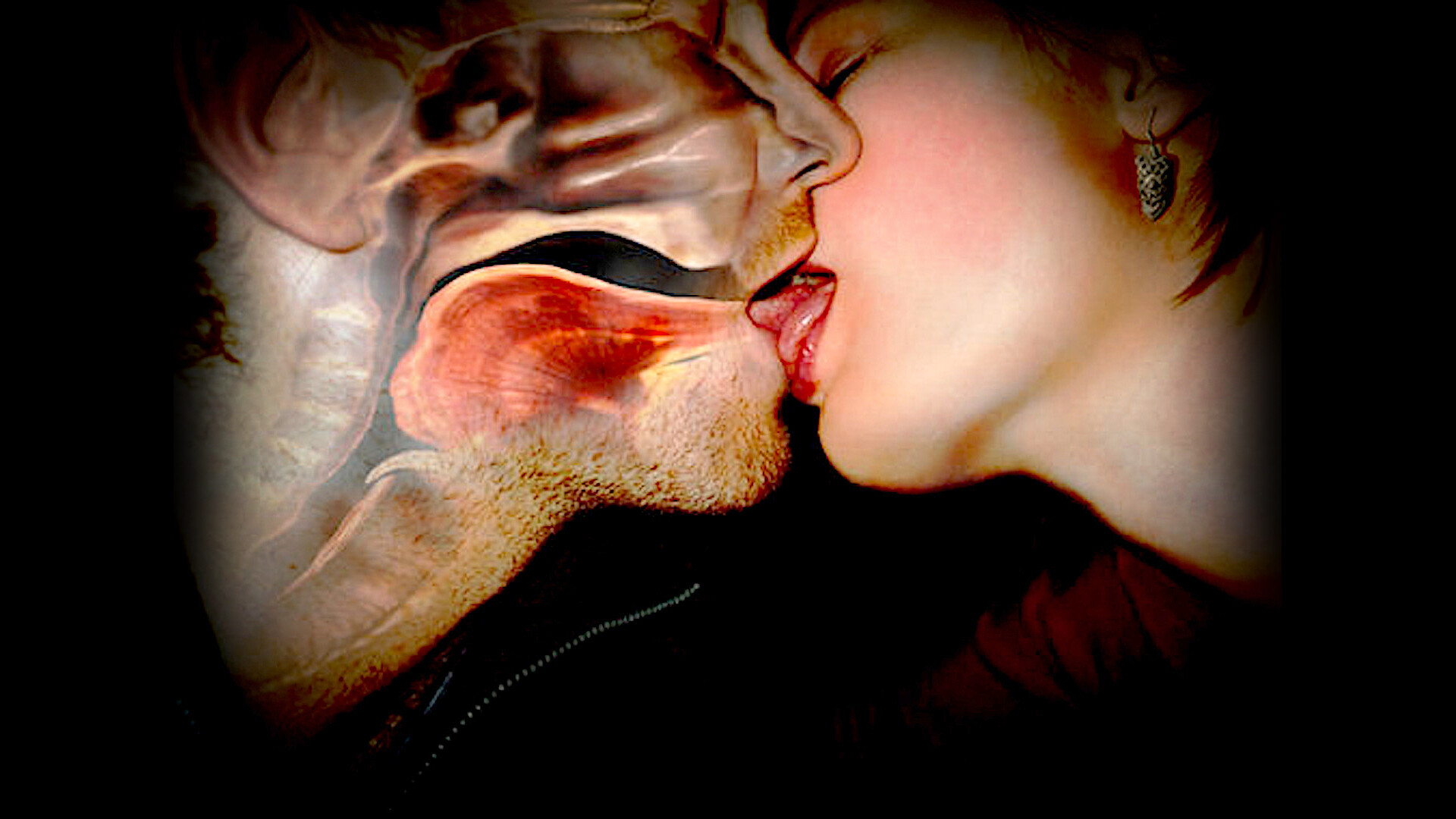 Mononucleosis (Mono/Kissing Disease): Symptoms and Causes