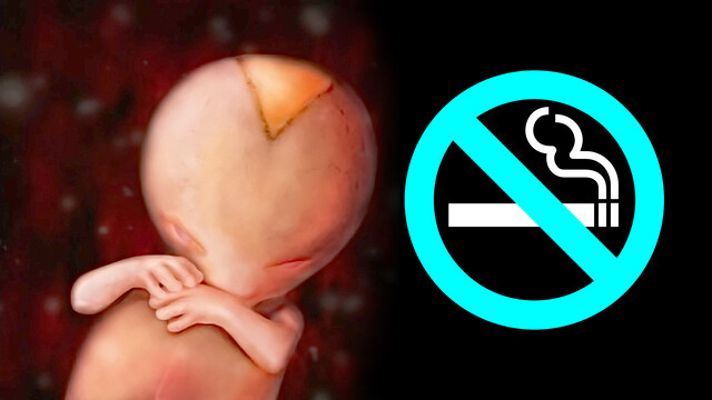 e cigarettes and pregnancy Tobacco & Pregnancy webinar main image 0
