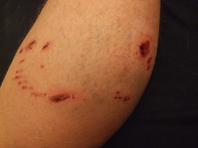 dog bites on human leg