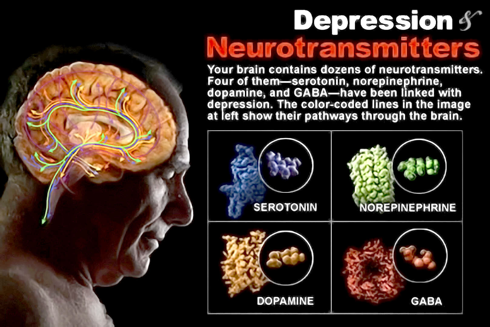 neurotransmitters in depression