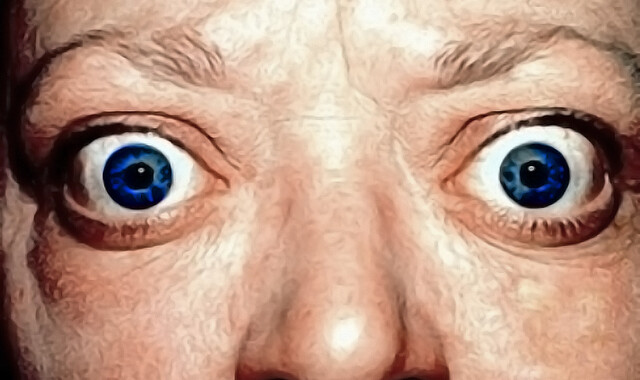 Can Smoking Cause Graves' Ophthalmopathy or Thyroid Eye Disease?