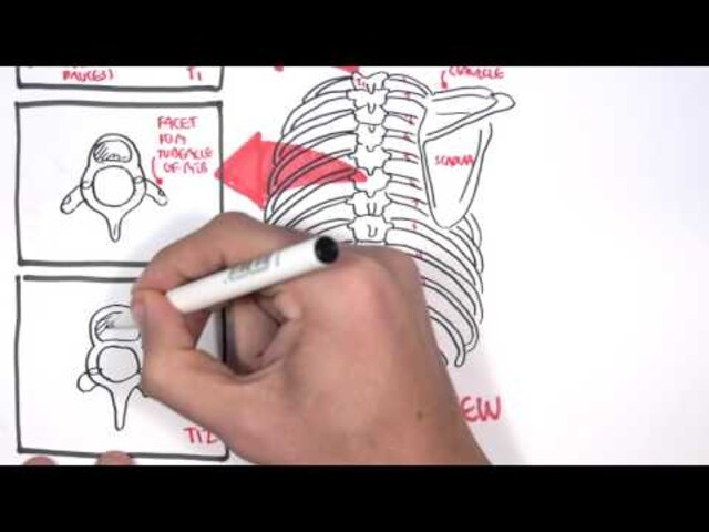 Thoracentesis - StoryMD