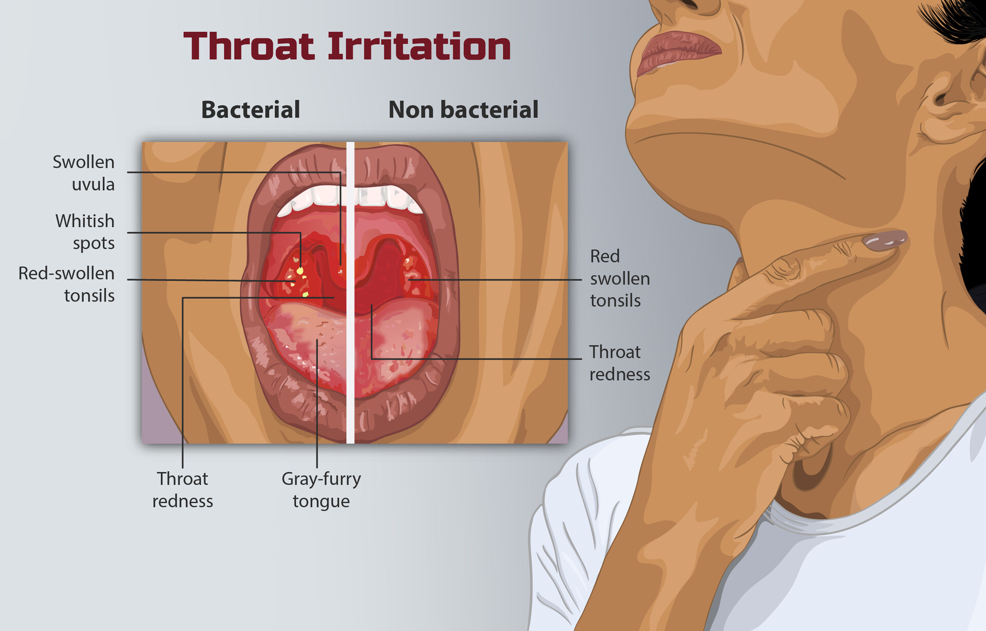 Throat Disorders StoryMD