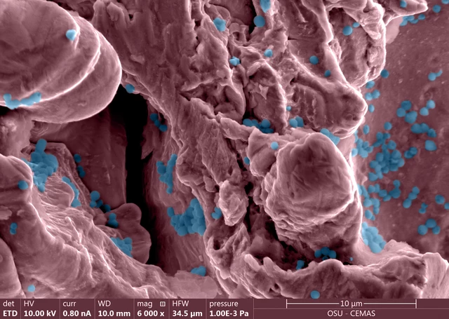 Staphylococcal Infections - StoryMD