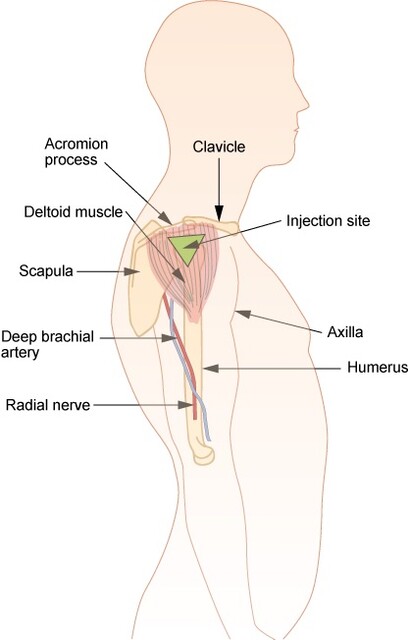 Administering Intramuscular Injections–Health Professional Version