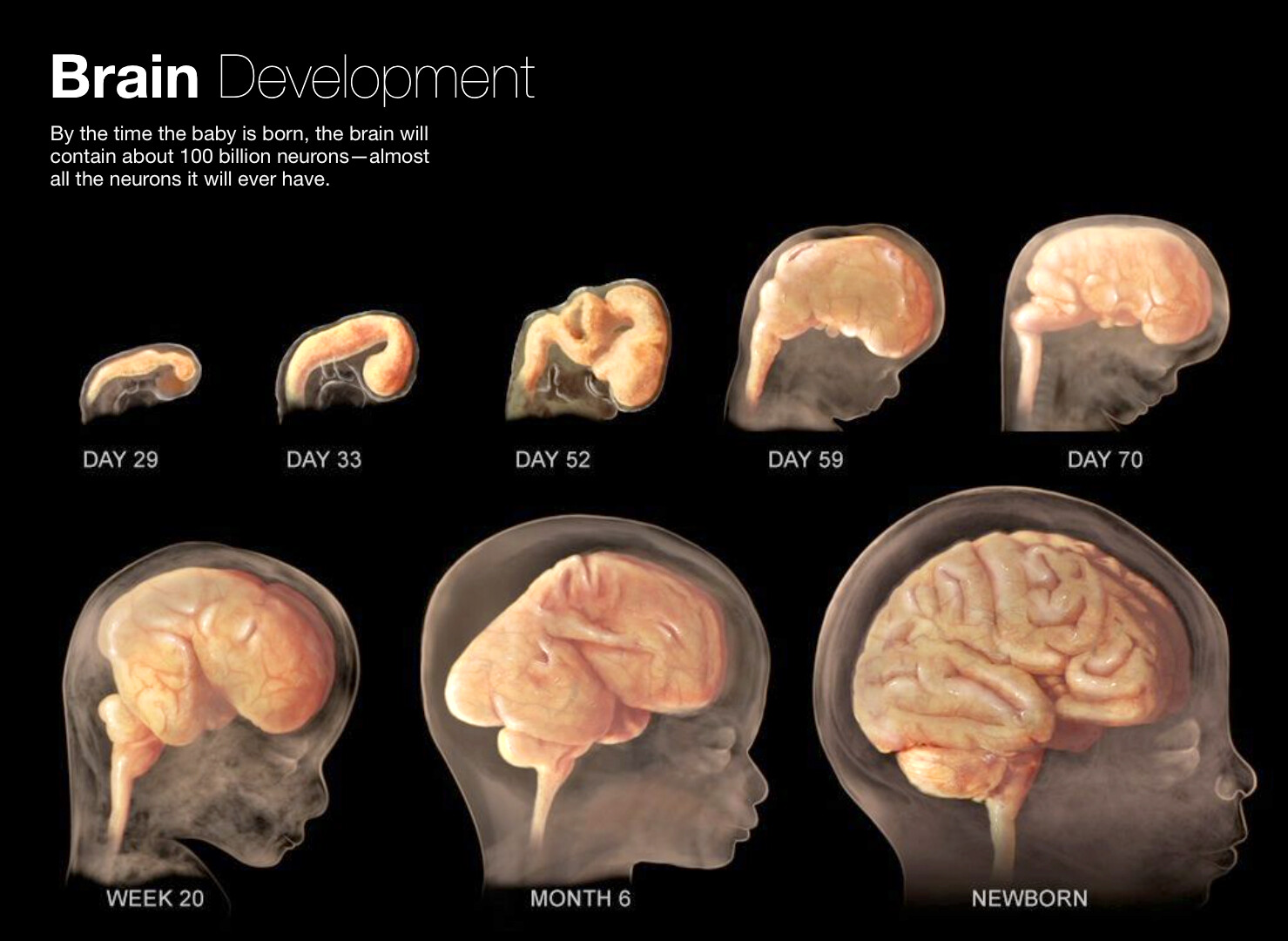 Neurodevelopment - StoryMD