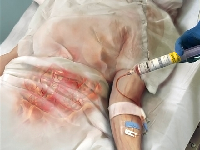 Cancer Journey