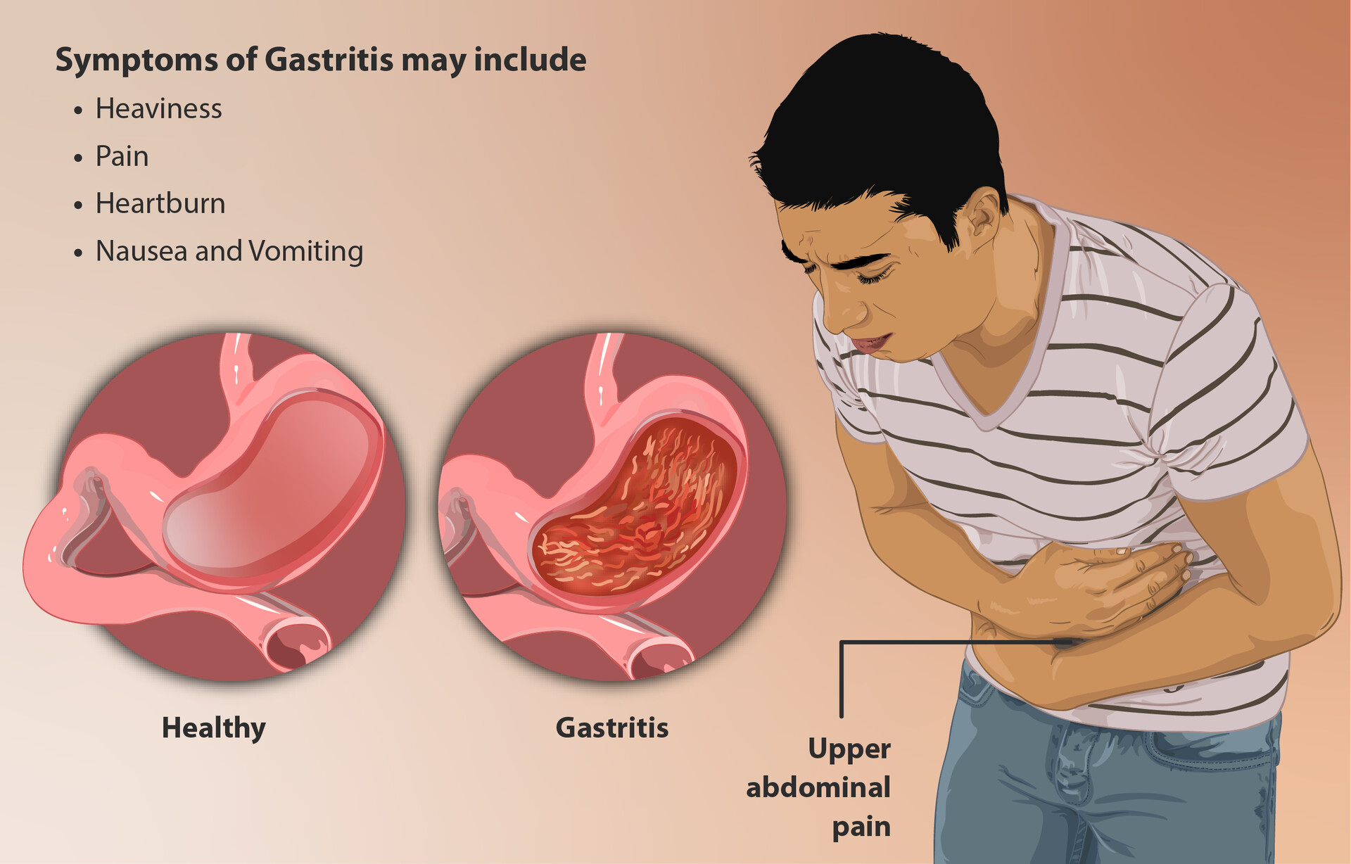 what-are-gastritis-and-gastropathy-storymd