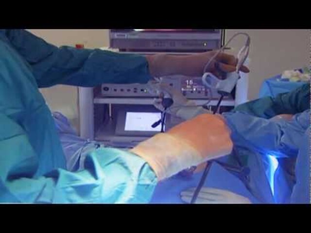 Laparoscopic oophorectomy - Mayo Clinic