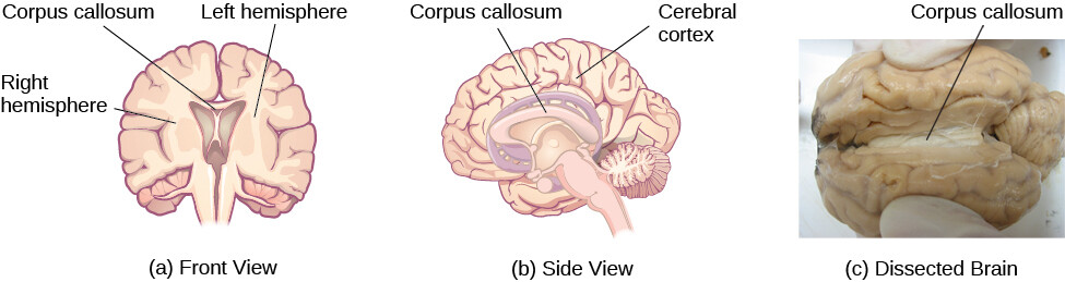 corpus callosum diagram