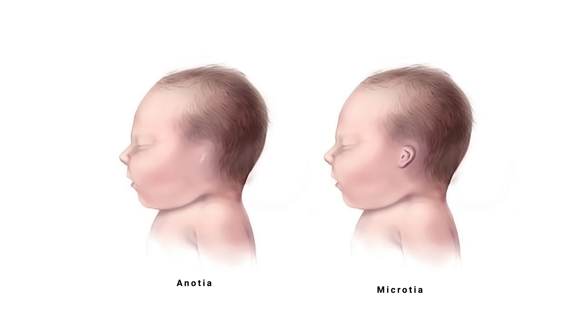 birth-defects-through-all-phases-of-life-storymd