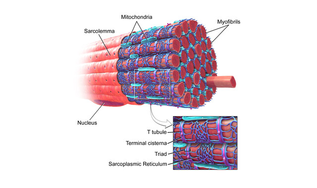 Myostatin Related Muscle Hypertrophy Causes Inheritance Diagnosis Storymd