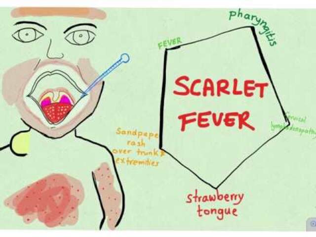 Scarlet fever revealed  Dr Morton's - the medical helpline
