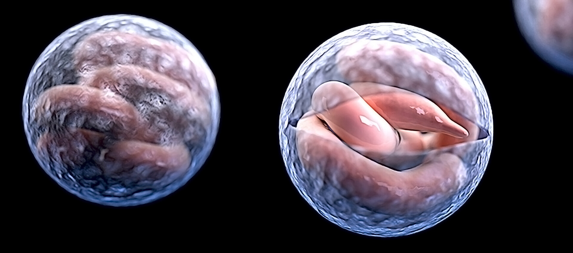 Cryptosporidiosis (Crypto): Causes, Symptoms, Treatment - StoryMD