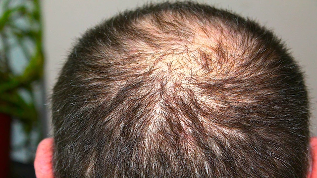 Liquid Biotin for Hair Growth - Does it Work?