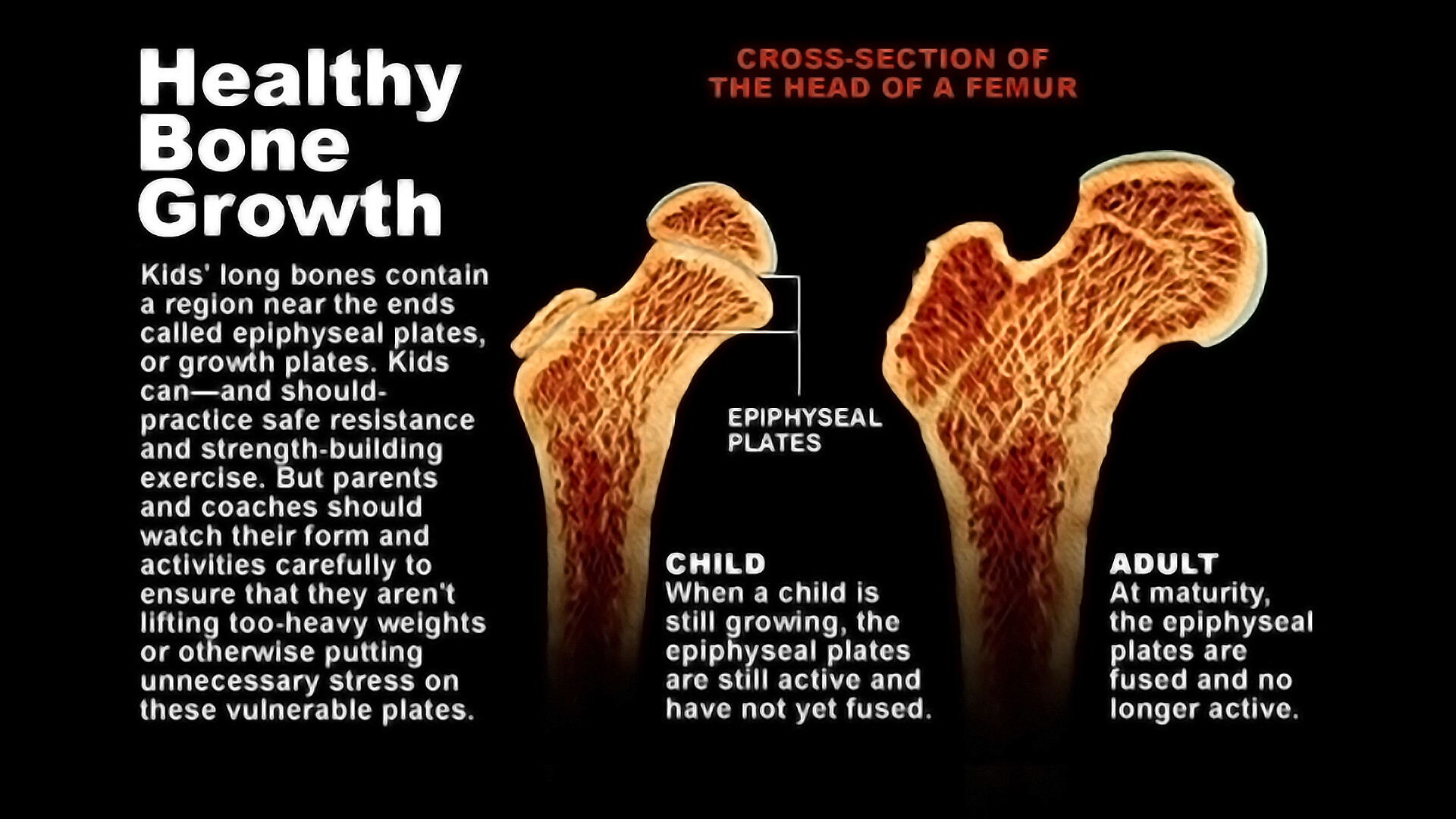 benefits-of-physical-activity-strengthen-your-bones-and-muscles-storymd