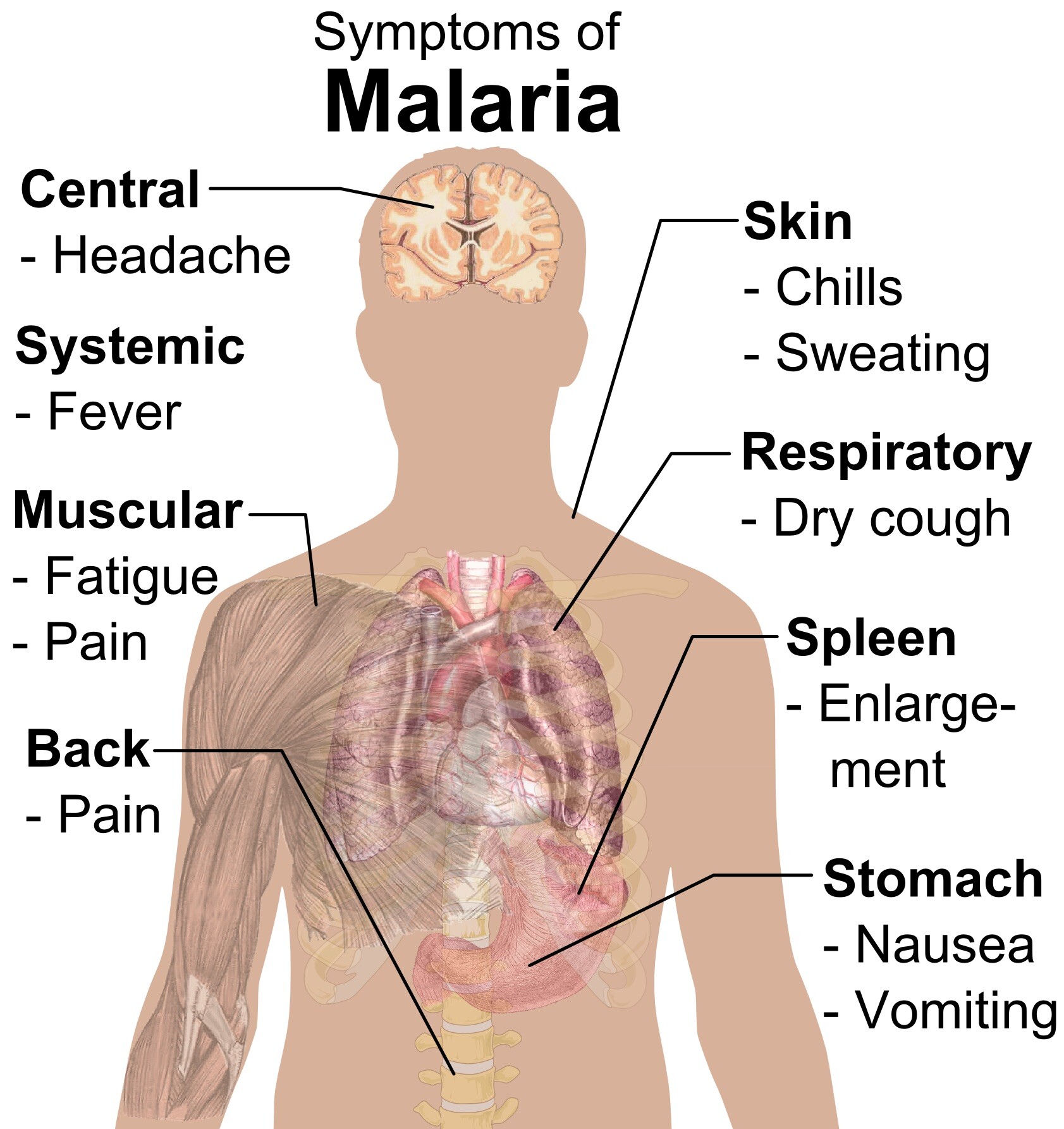 Малярия основное