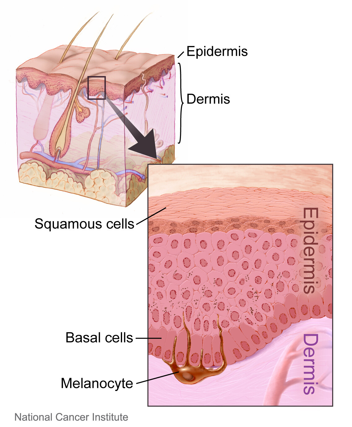 What Is Elastoderma Storymd